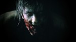 RESIDENT EVIL 2 Deluxe Edition XBOX ONE/X|S  КЛЮЧ - изображение № 3
