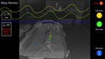  Baby Monitor for Kinect XBOX ONE Цифровой Ключ  - изображение № 6