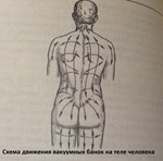 Реферат на тему Баночный массаж Вакуумный массаж - изображение № 2