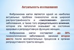 ДИПЛОМ УХОД ЗА ПАЦИЕНТАМИ С ФИБРОМИОМОЙ МАТКИ - изображение № 2