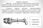 ДИПЛОМ СЕСТРИНСКИЙ УХОД ПРИ СКЕЛЕТНОМ ВЫТЯЖЕНИИ - изображение № 3