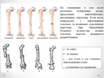 ДИПЛОМ СЕСТРИНСКИЙ УХОД ПРИ СКЕЛЕТНОМ ВЫТЯЖЕНИИ