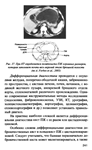 Н.Б Губергриц. Практическая панкреатология - изображение № 7