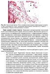 Пауков В.С. - Патологическая анатомия. Том 2 - изображение № 5