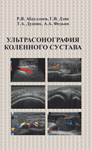 Ультрасонография коленного сустава - Абдуллаев Р.Я.