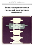Рентгенодиагностика смещений поясничных позвонков 1979