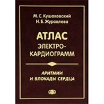 Аритмии и блокады сердца. Атлас электрокардиограмм.