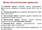 Варианты прикусов у человека - изображение № 3