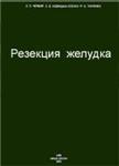 Резекция желудка Русанов А.А. 1986г.